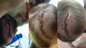 Ian's injuries as they have progressed